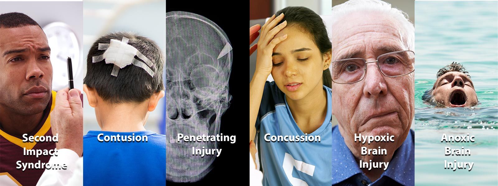 types of traumatic brain injuries